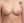 豊胸術（シリコンインプラント／人工乳腺） — 術後 (26日) · ザ・美容外科
