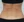 Radiofrequency fat reduction — abdomen — before (17days) · BLS Clinic - Main Branch