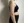 Full-body liposuction — before (14days) · Line & View Clinic