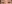 切開法（全切開法二重術） — エイペックス美容外科クリニック
