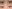二重まぶた（自然癒着法） — フルルン美容外科クリニック