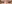 二重まぶた（自然癒着法） — SM美容外科クリニック