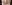 顔の脂肪吸引 — クレア美容外科クリニック