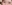 二重まぶた（自然癒着法） — アウラ美容外科クリニック