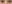 裏ハムラ法（経結膜的眼窩脂肪移動術） — ハッシュ美容外科クリニック