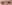 目頭切開（蒙古襞除去） — エイペックス美容外科クリニック