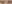 二重まぶた（自然癒着法） — プロミス美容外科クリニック