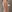豊胸術（シリコンインプラント／人工乳腺） — バナナ美容外科クリニック