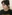 Bulbous nose correction (surgical nasal tip reduction) — DM Plastic Surgery Clinic