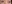 裏ハムラ法（経結膜的眼窩脂肪移動術） — プレジャー美容外科クリニック