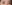 二重まぶた（自然癒着法） — ベリーグッド美容外科