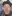 Onda (Coolwaves microwave) lifting — J.Fill Clinic - Gangnam Branch