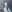 Full-face fat grafting (autologous fat transfer) — Mind Plastic Surgery