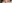 裏ハムラ法（経結膜的眼窩脂肪移動術） — プレジャー美容外科クリニック