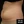 สลายไขมันต้นขาด้วยคลื่นวิทยุ (RF) — ก่อนทำ (44วัน) · ชุงดัมมายคลินิก