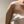 Shoulder lipolysis injection (fat-dissolving injection) — after (21days) · Pleasure Plastic Surgery Clinic