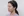 Paranasal (nasal base) augmentation with implant — before (30days) · Dr. Song For You Clinic