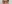 二重まぶた（自然癒着法） — フルルン美容外科クリニック