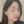 Onda (Coolwaves ไมโครเวฟ ลดไขมันและยกกระชับ) — หลังทำ · Beauty Blossom Clinic