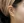 ฟิลเลอร์ติ่งหู (เสริมติ่งหู / หูมงคล) — ก่อนทำ · คลินิกยูพิค สาขาซองโด