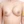 Hybrid breast augmentation (implant + fat grafting) — before (28days) · The Plastic Surgery Clinic