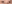 二重まぶた（自然癒着法） — イエロー美容外科クリニック