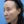 Ultherapy (Ulthera) micro-focused ultrasound lift — before · K-Tox Clinic - Incheon Guwol Branch