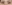 二重まぶた（自然癒着法） — フルルン美容外科クリニック