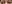二重まぶた（自然癒着法） — フルルン美容外科クリニック