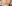 鼻尖形成術（自家軟骨移植） — コ・アン・ミ美容外科クリニック