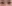 二重まぶた（自然癒着法） — アイフィット美容外科クリニック