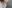 糸リフト（スレッドリフト） — フェイスプラス美容外科クリニック
