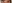 二重まぶた（自然癒着法） — プロミス美容外科クリニック