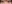 二重まぶた（自然癒着法） — VAVA美容外科クリニック
