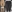 Thigh liposuction — Fitting Clinic