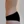 Back liposuction — after (13days) · Hourglass Clinic