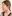 鼻尖形成術（自家軟骨移植） — ハイエンド美容外科クリニック
