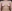 豊胸術（シリコンインプラント／人工乳腺） — エイト美容外科クリニック