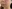 Juvelook (PDLLA + HA collagen-stimulating skin booster) — You&I Clinic - Myeongdong Branch