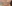 エラボトックス — フルルン美容外科クリニック