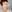 revision rhinoplasty — Anersty Plastic Surgery Clinic