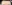額縮小術（生え際下げ・ヘアライン下降術） — コウユ美容外科クリニック