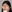 Tip plasty with donated (homologous rib) cartilage — Top Class Plastic Surgery Clinic