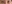 二重まぶた（自然癒着法） — リンク美容外科クリニック