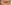 裏ハムラ法（経結膜的眼窩脂肪移動術） — ジャスト美容外科クリニック