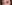 二重まぶた（自然癒着法） — プロミス美容外科クリニック
