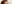 糸リフト（スレッドリフト） — A-Top美容外科クリニック