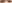 切開法（全切開法二重術） — Unique Plastic Surgery Clinic