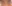 裏ハムラ法（経結膜的眼窩脂肪移動術） — エイペックス美容外科クリニック