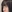 団子鼻修正（鼻尖縮小術） — ワンダフル美容外科クリニック